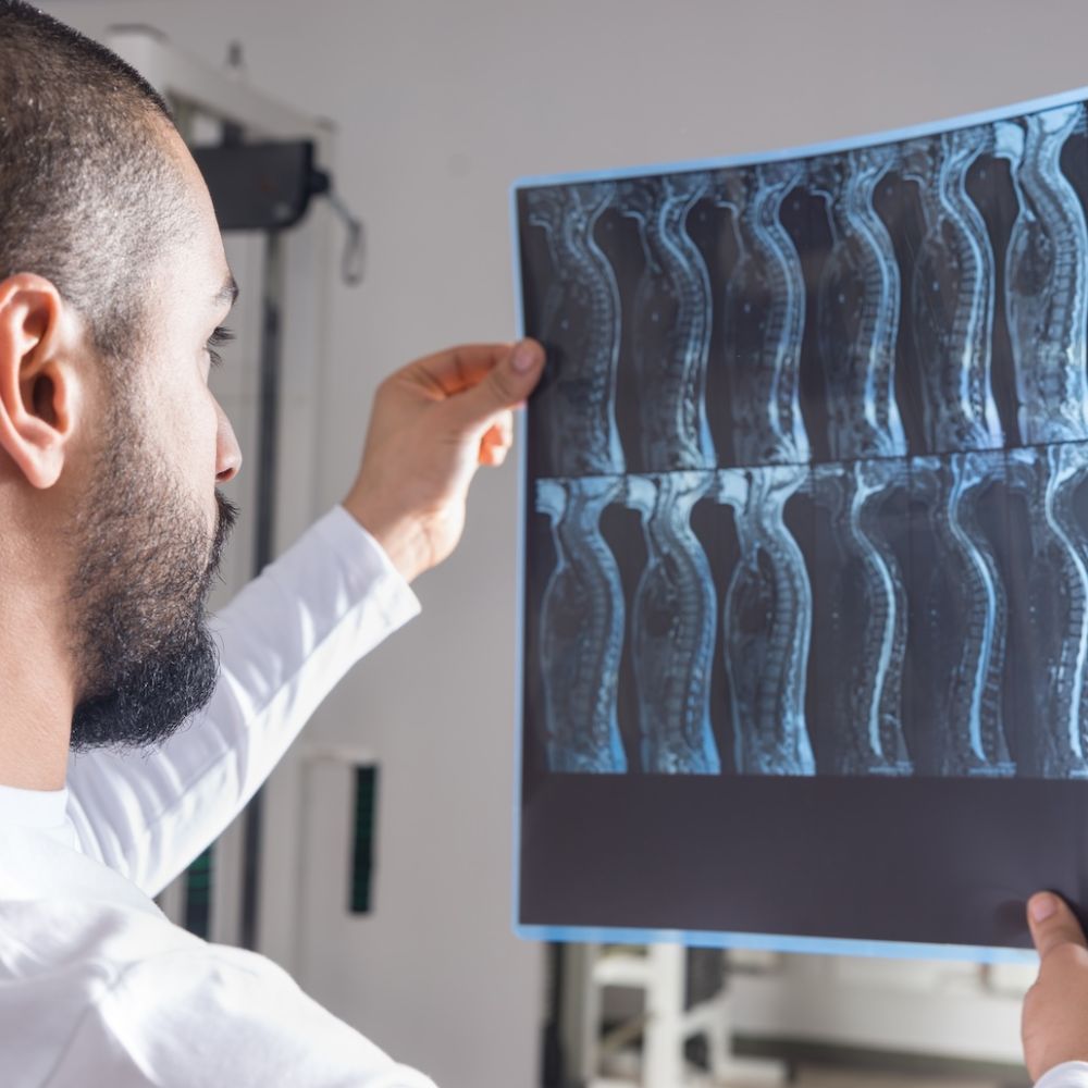 Doctor examining spinal X-ray images for medical diagnosis in a hospital setting.