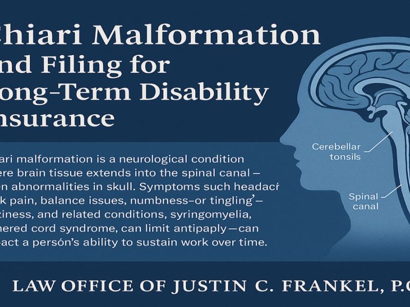 Diagram showing a brain's cerebellar tonsils extending into the spinal canal, with surrounding text. Text: "Chiari Malformation and Filing for Long-Term Disability Insurance. Chiari malformation is a neurological condition where brain tissue extends into the spinal canal—often abnormalities in skull. Symptoms such headache, neck pain, balance issues, numbness—or tingling—dizziness, and related conditions, syringomyelia, tethered cord syndrome, can limit anticaply—can impact a person’s ability to sustain work over time. LAW OFFICE OF JUSTIN C. FRANKEL, P.C."