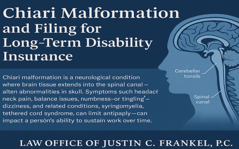 Diagram showing a brain's cerebellar tonsils extending into the spinal canal, with surrounding text. Text: "Chiari Malformation and Filing for Long-Term Disability Insurance. Chiari malformation is a neurological condition where brain tissue extends into the spinal canal—often abnormalities in skull. Symptoms such headache, neck pain, balance issues, numbness—or tingling—dizziness, and related conditions, syringomyelia, tethered cord syndrome, can limit anticaply—can impact a person’s ability to sustain work over time. LAW OFFICE OF JUSTIN C. FRANKEL, P.C."