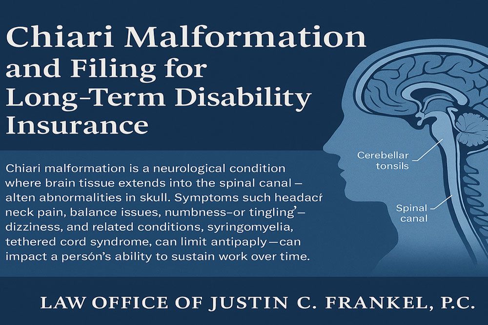 Diagram showing a brain's cerebellar tonsils extending into the spinal canal, with surrounding text. Text: "Chiari Malformation and Filing for Long-Term Disability Insurance. Chiari malformation is a neurological condition where brain tissue extends into the spinal canal—often abnormalities in skull. Symptoms such headache, neck pain, balance issues, numbness—or tingling—dizziness, and related conditions, syringomyelia, tethered cord syndrome, can limit anticaply—can impact a person’s ability to sustain work over time. LAW OFFICE OF JUSTIN C. FRANKEL, P.C."